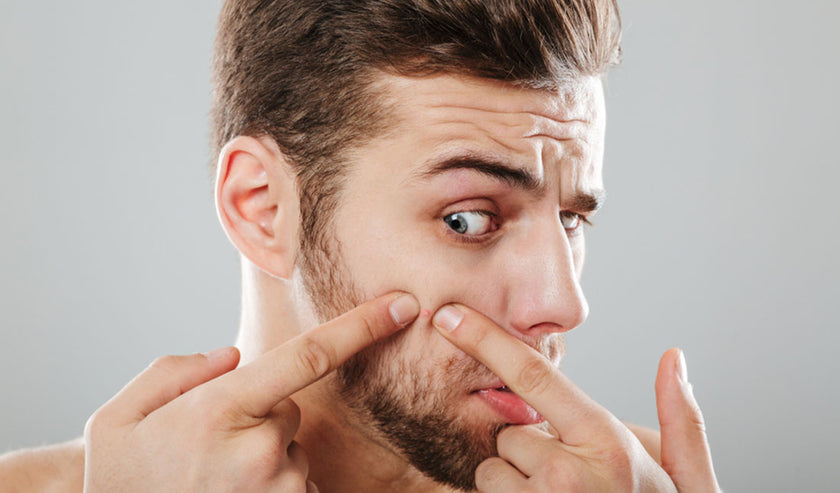 man squeezing pimples man squeezing pimples
